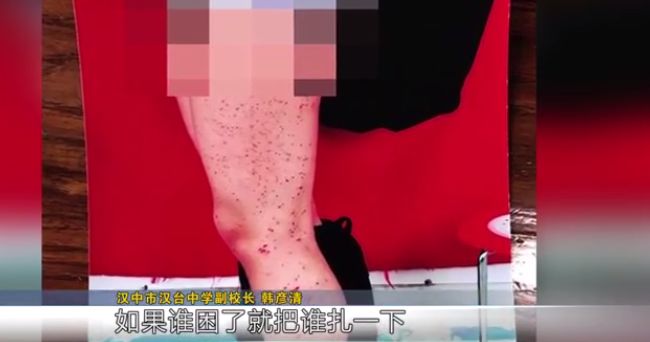 高中女生腿上密密麻麻全是血点居然是男同桌扎的